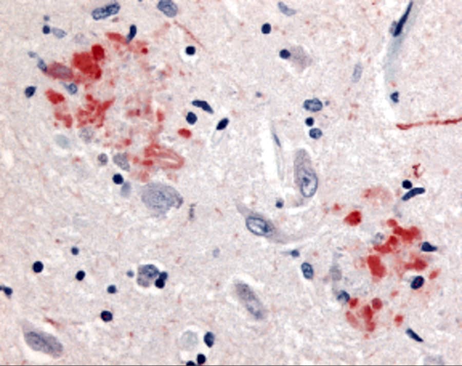 beta Amyloid Antibody - BSA Free