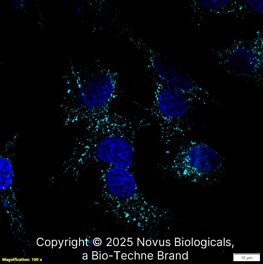 LAMP-1/CD107a Antibody (H4A3) [Alexa Fluor® 647]