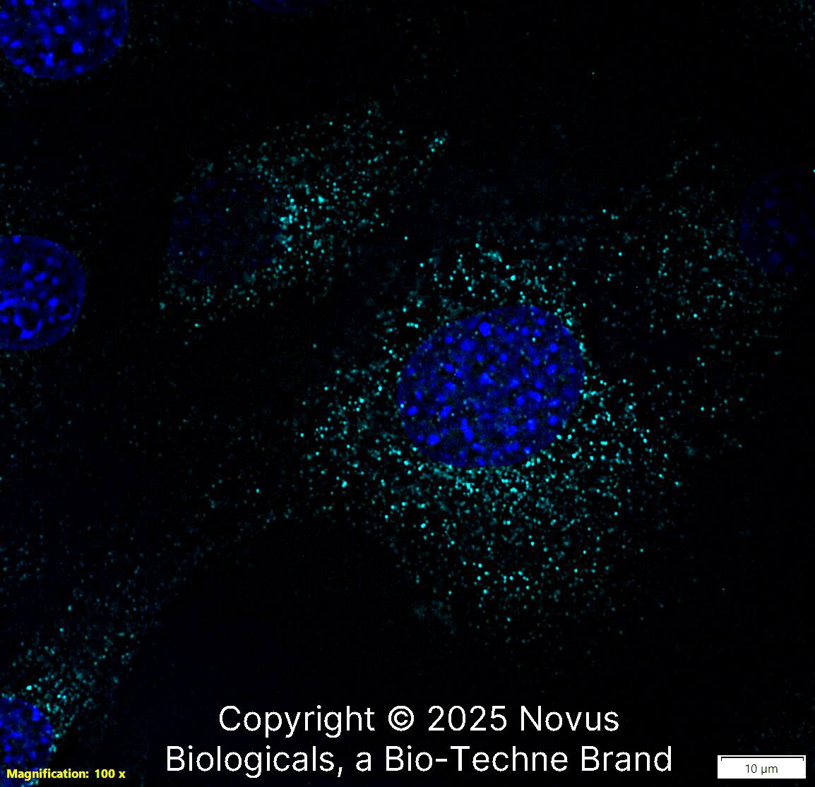 LAMP-1/CD107a Antibody (H4A3) [Alexa Fluor® 647]