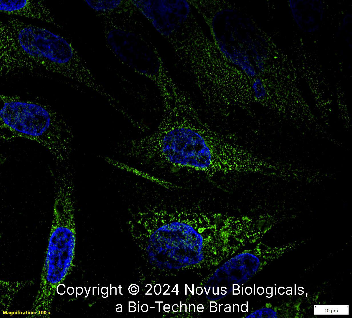 CCR6 Antibody (18B9E6) [Alexa Fluor® 488]