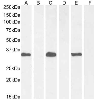 BRN3B/POU4F2 Antibody