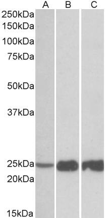 Troponin I type 2 (fast skeletal) Antibody