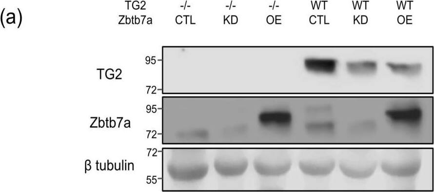 Transglutaminase 2/TGM2 Antibody (CUB7402)