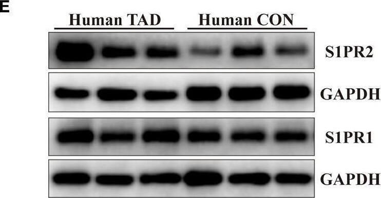 S1P2/EDG-5/S1PR2 Antibody - BSA Free
