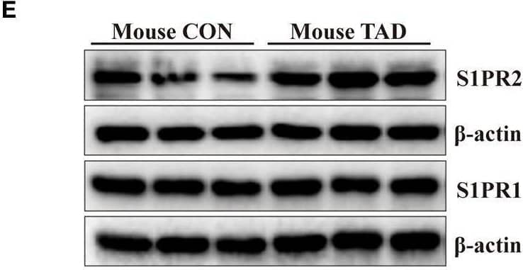 S1P2/EDG-5/S1PR2 Antibody - BSA Free