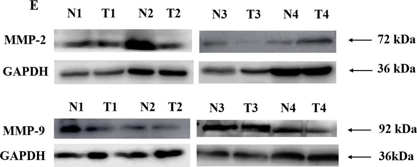 MMP-2 Antibody