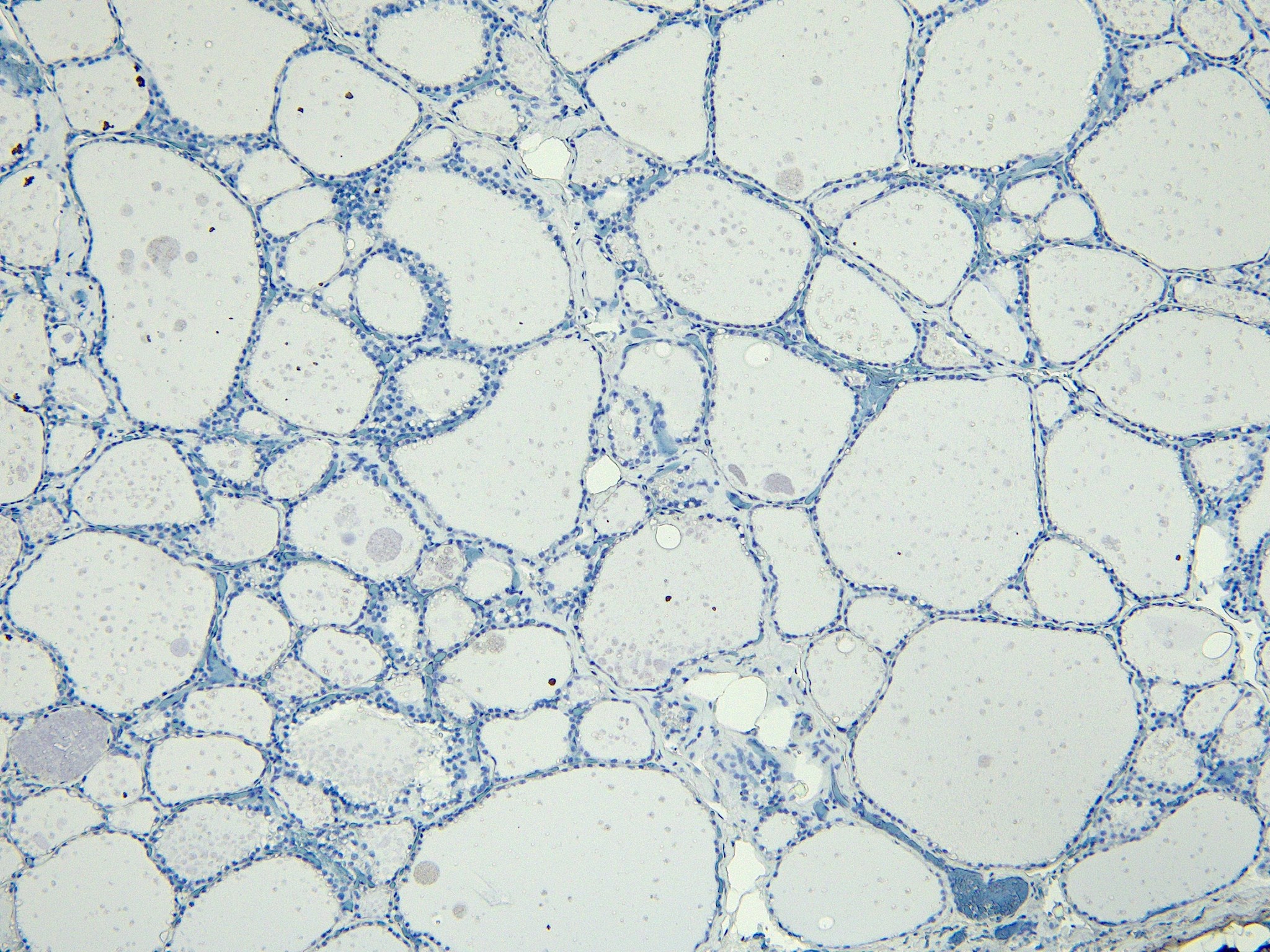 ENPP-1 Antibody