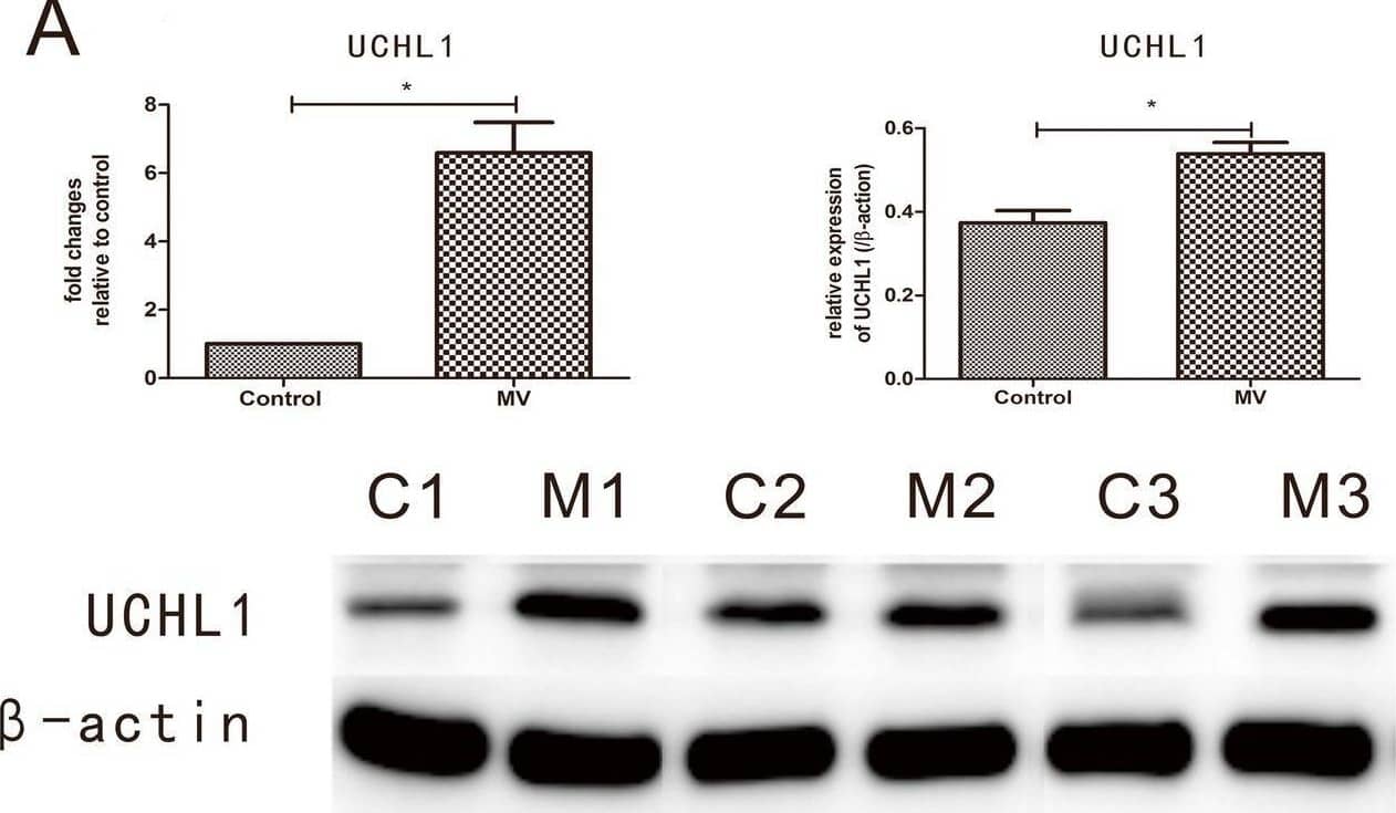 UCH-L1/PGP9.5 Antibody (13C4)