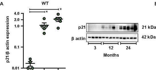 p21/CIP1/CDKN1A Antibody (WA-1)
