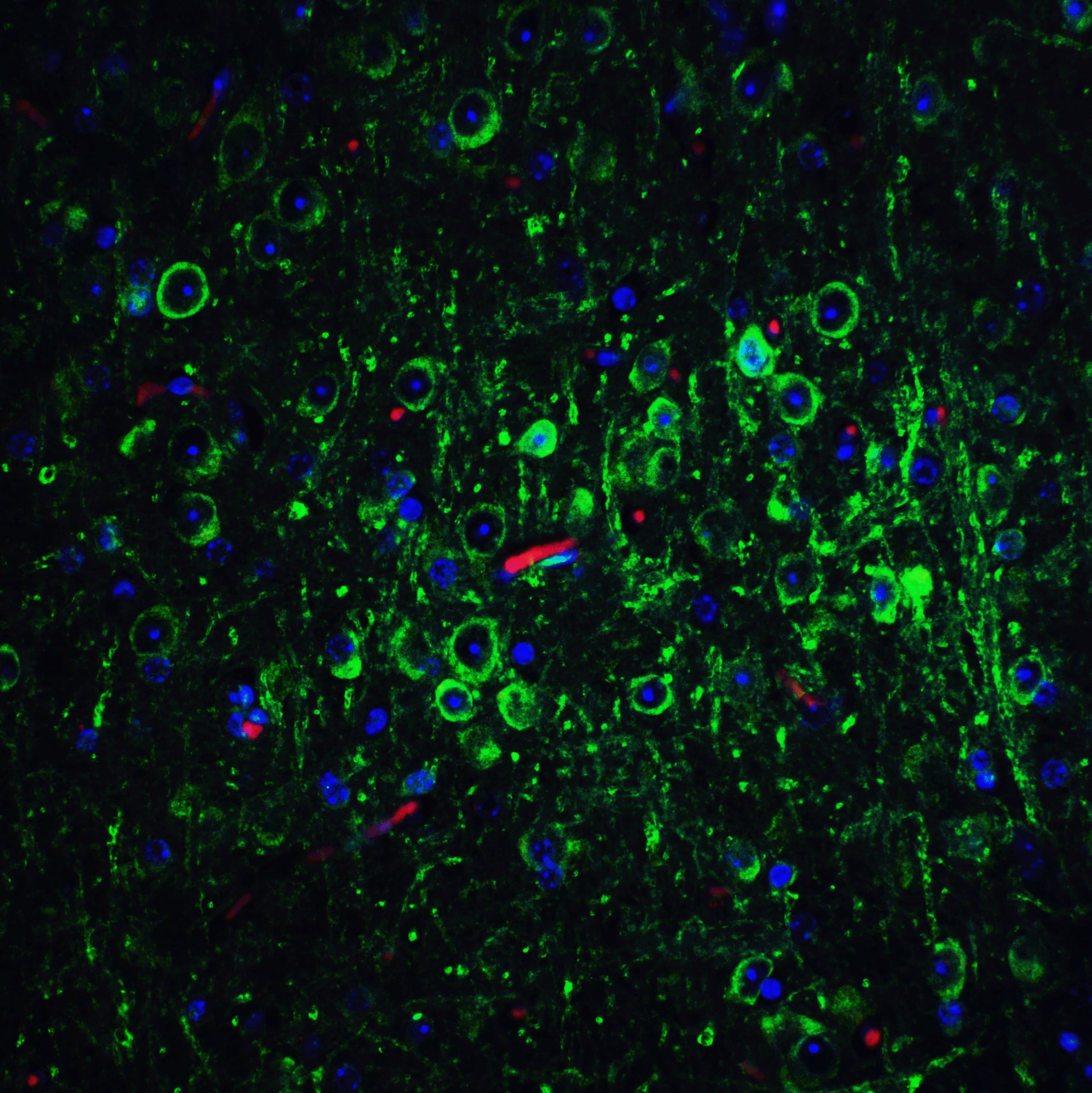 Bcl-2 Antibody - BSA Free