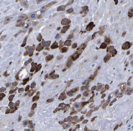 LEPRE1 Antibody LEPRE1 Antibody