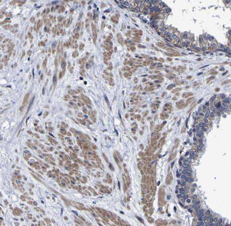 LEPRE1 Antibody LEPRE1 Antibody