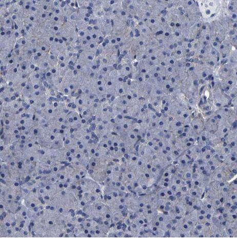 LEPRE1 Antibody LEPRE1 Antibody