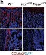 Collagen IX alpha 2 Antibody