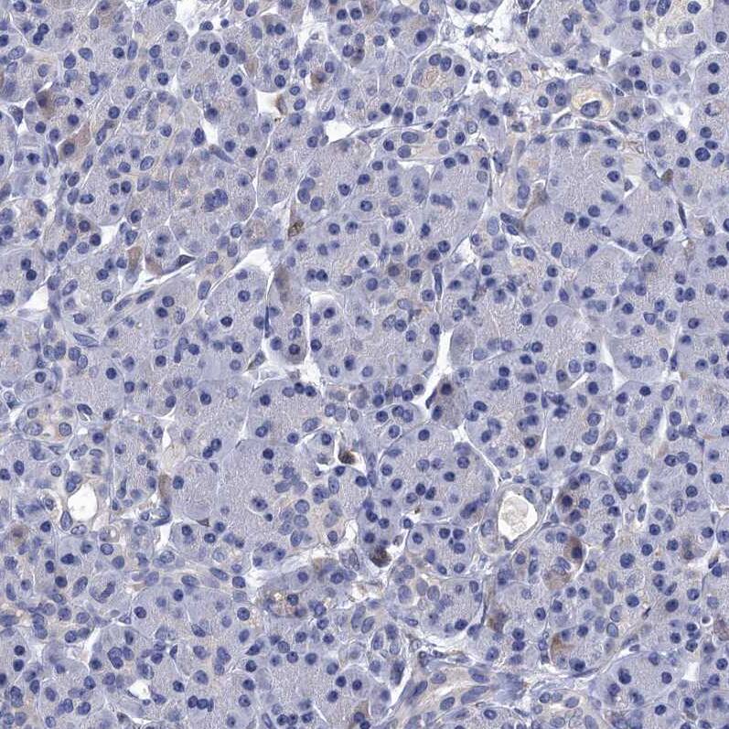 Mindin/Spondin-2 Antibody - BSA Free Immunohistochemistry-Paraffin: Mindin/Spondin-2 Antibody [NBP2-30500]