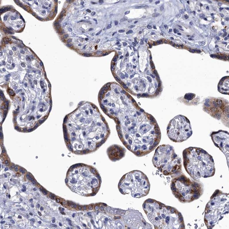 Mindin/Spondin-2 Antibody - BSA Free Immunohistochemistry-Paraffin: Mindin/Spondin-2 Antibody [NBP2-30500]