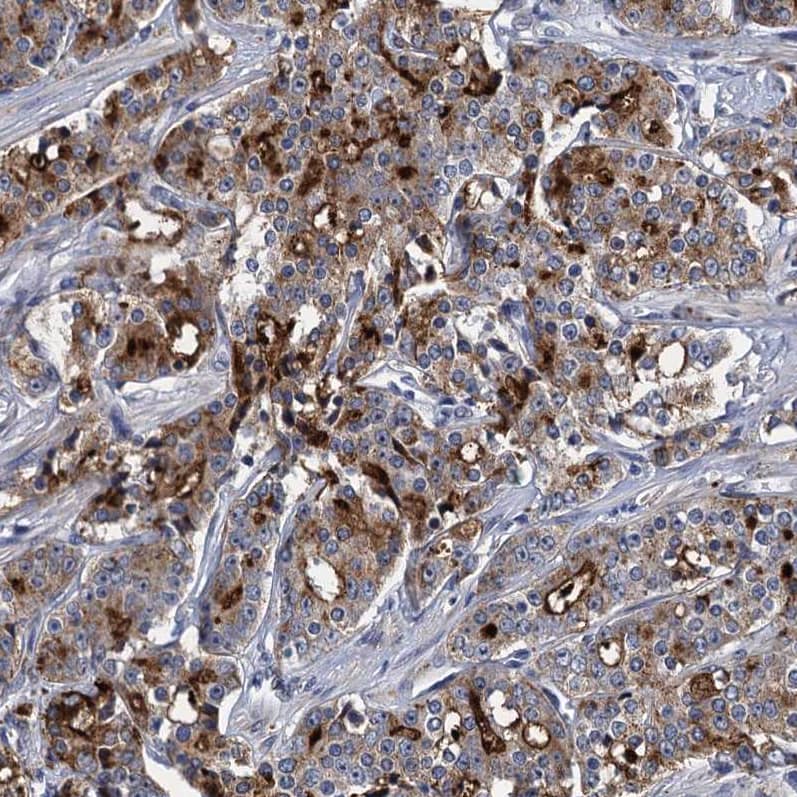 Mindin/Spondin-2 Antibody - BSA Free Immunohistochemistry-Paraffin: Mindin/Spondin-2 Antibody [NBP2-30500]