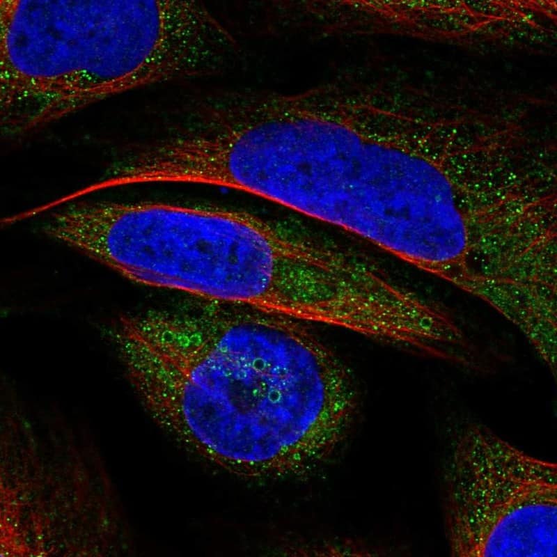 VWA8 Antibody - BSA Free Immunocytochemistry/ Immunofluorescence: VWA8 Antibody [NBP2-30596]