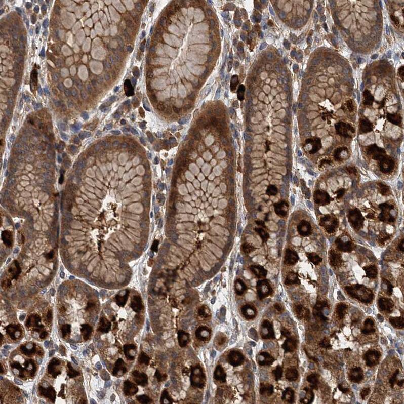 LOH12CR1 Antibody - BSA Free Immunohistochemistry-Paraffin: LOH12CR1 Antibody [NBP2-30597]