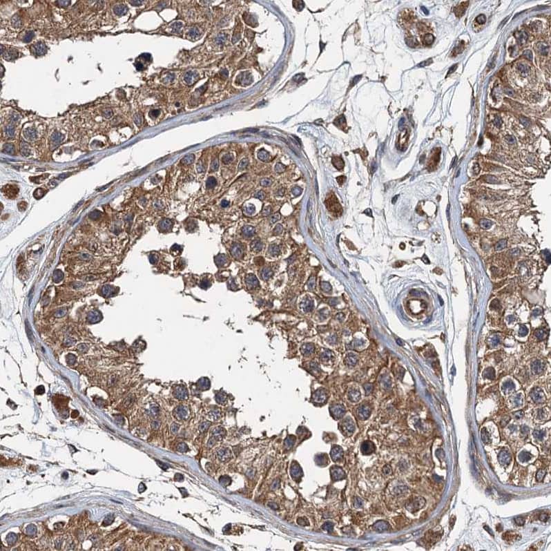 LOH12CR1 Antibody - BSA Free Immunohistochemistry-Paraffin: LOH12CR1 Antibody [NBP2-30597]