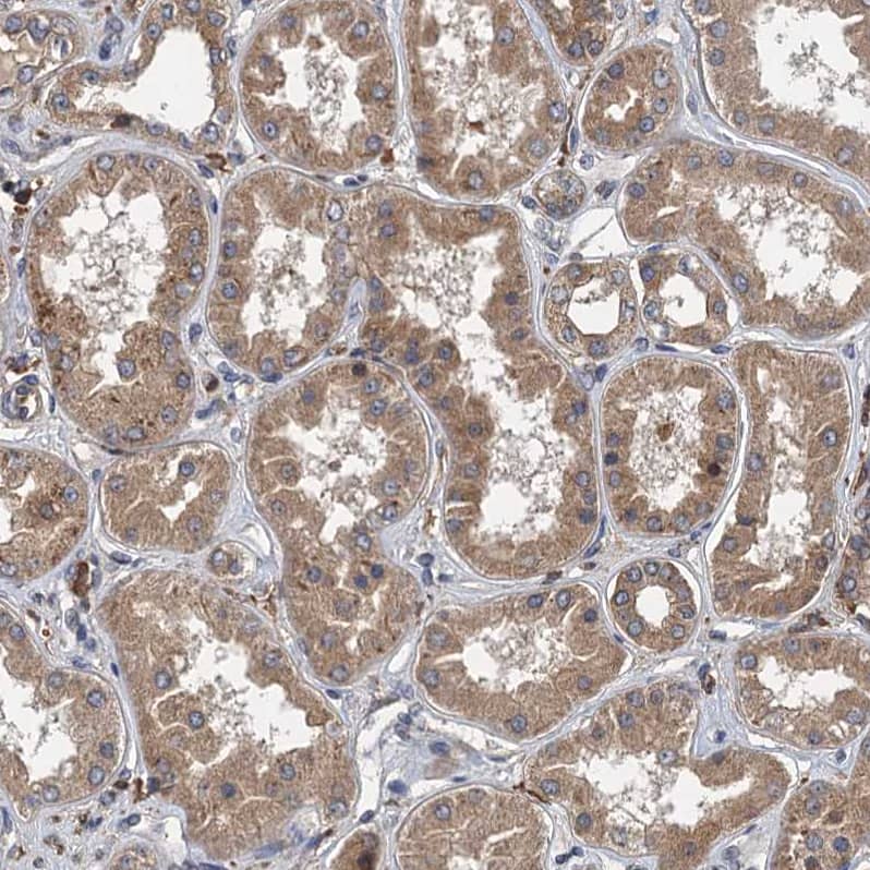 LOH12CR1 Antibody - BSA Free Immunohistochemistry-Paraffin: LOH12CR1 Antibody [NBP2-30597]