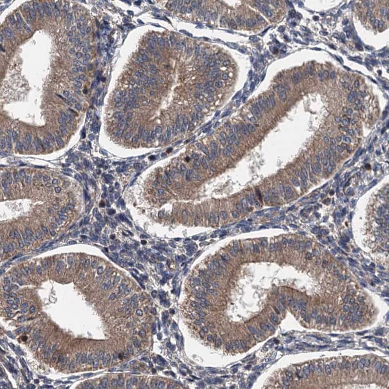 LOH12CR1 Antibody - BSA Free Immunohistochemistry-Paraffin: LOH12CR1 Antibody [NBP2-30597]