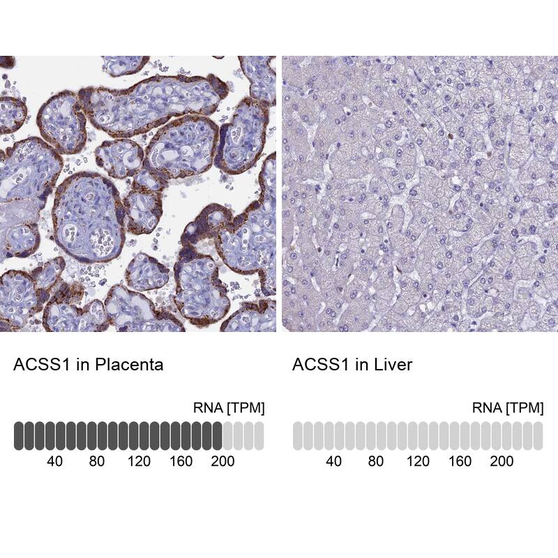 ACSS1 Antibody - BSA Free Immunohistochemistry-Paraffin: ACSS1 Antibody [NBP2-30612]