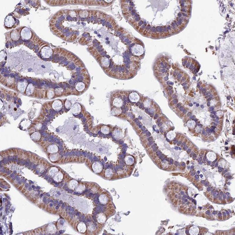 ACSS1 Antibody - BSA Free Immunohistochemistry-Paraffin: ACSS1 Antibody [NBP2-30612]