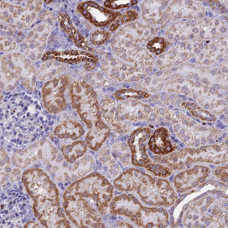 ACSS1 Antibody - BSA Free Immunohistochemistry-Paraffin: ACSS1 Antibody [NBP2-30612]