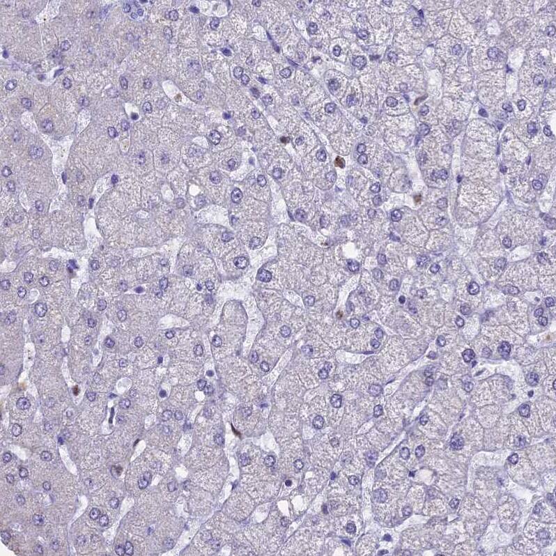 ACSS1 Antibody - BSA Free Immunohistochemistry-Paraffin: ACSS1 Antibody [NBP2-30612]