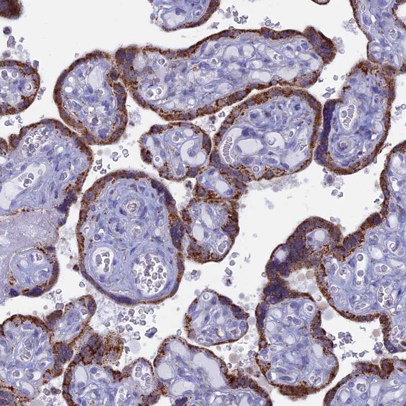 ACSS1 Antibody - BSA Free Immunohistochemistry-Paraffin: ACSS1 Antibody [NBP2-30612]