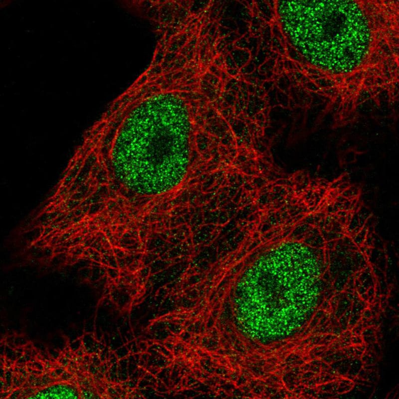 TCF-2/HNF-1 beta Antibody (CL0374) - BSA Free Immunocytochemistry/ Immunofluorescence: TCF-2/HNF-1 beta Antibody (CL0374) [NBP2-30678]