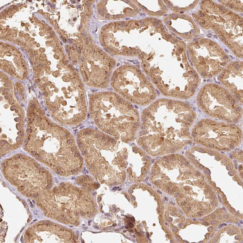 Fucosyltransferase 8/FUT8 Antibody - BSA Free Immunohistochemistry: Fucosyltransferase 8/FUT8 Antibody - BSA Free [Fucosyltransferase 8/FUT8 Antibody - BSA Free]