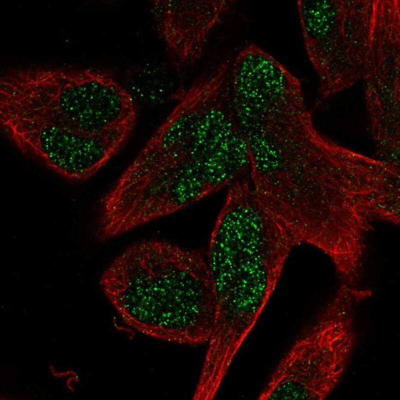 AEBP2 Antibody - BSA Free Immunocytochemistry/ Immunofluorescence: AEBP2 Antibody [NBP2-30712]