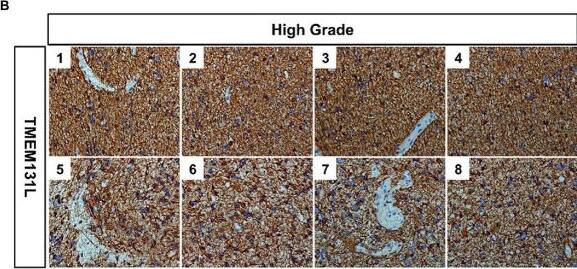 TMEM131L Antibody - BSA Free