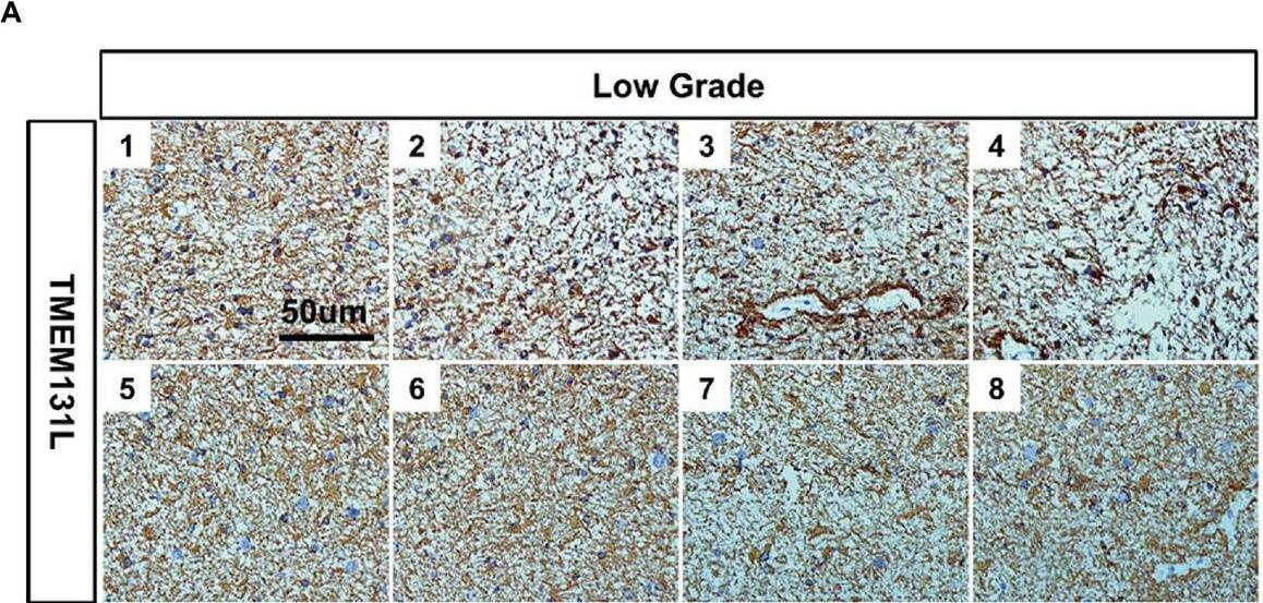 TMEM131L Antibody - BSA Free