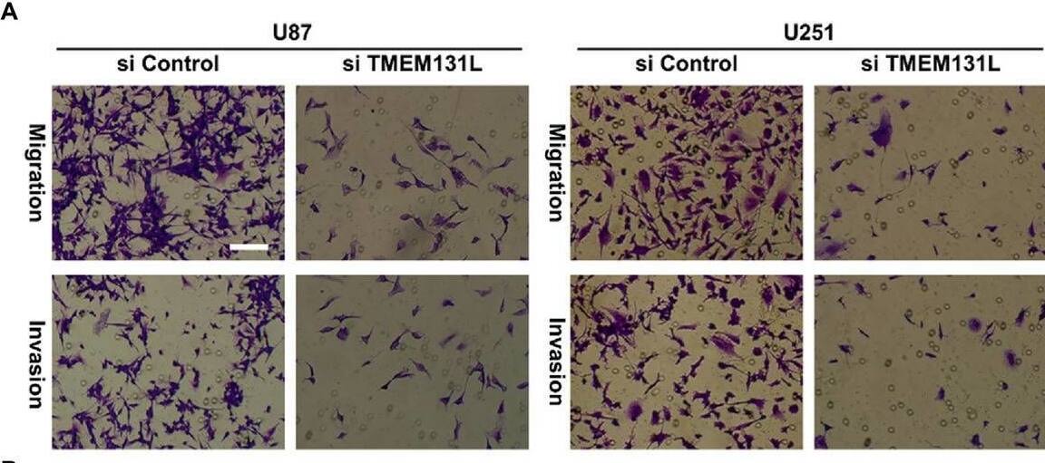 TMEM131L Antibody - BSA Free