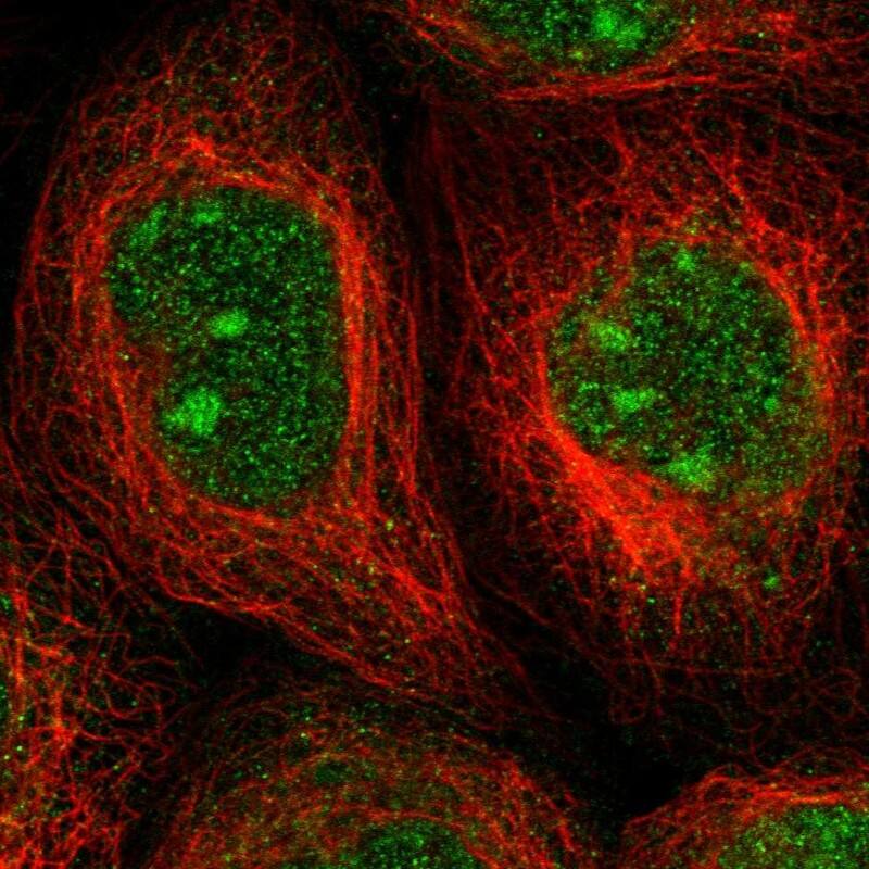 ALG14 Antibody - BSA Free Immunocytochemistry/ Immunofluorescence: ALG14 Antibody [NBP2-30914]
