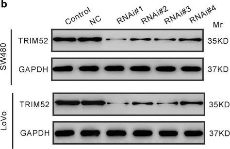 TRIM52 Antibody