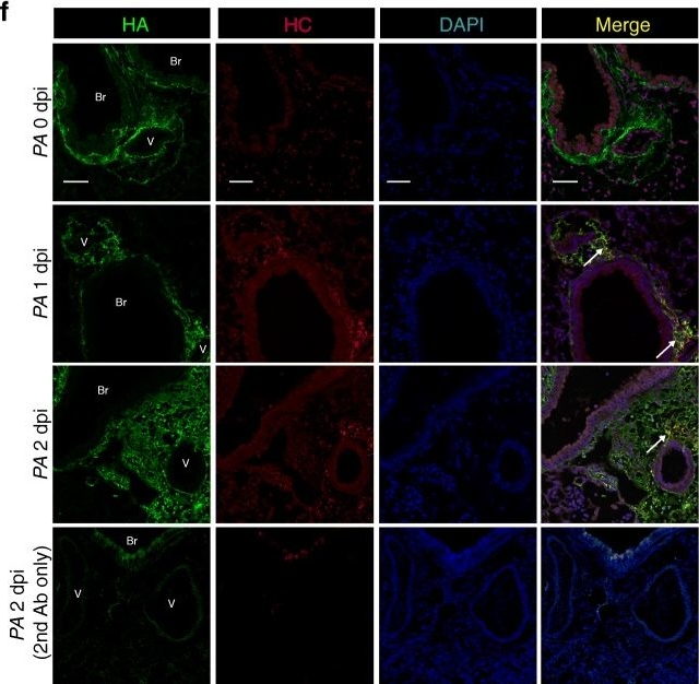 ITIH2 Antibody - BSA Free