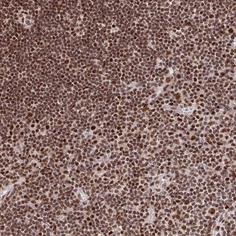 ZDHHC12 Antibody Immunohistochemistry-Paraffin: ZDHHC12 Antibody [NBP2-31763] -