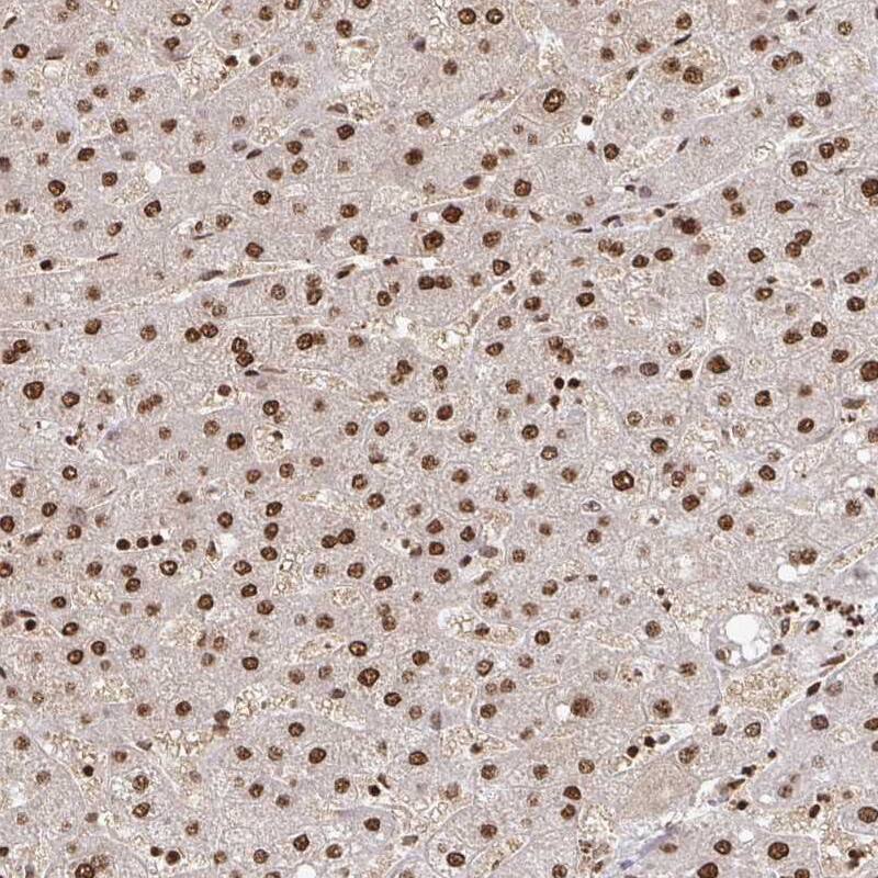 ZDHHC12 Antibody Immunohistochemistry-Paraffin: ZDHHC12 Antibody [NBP2-31763] -