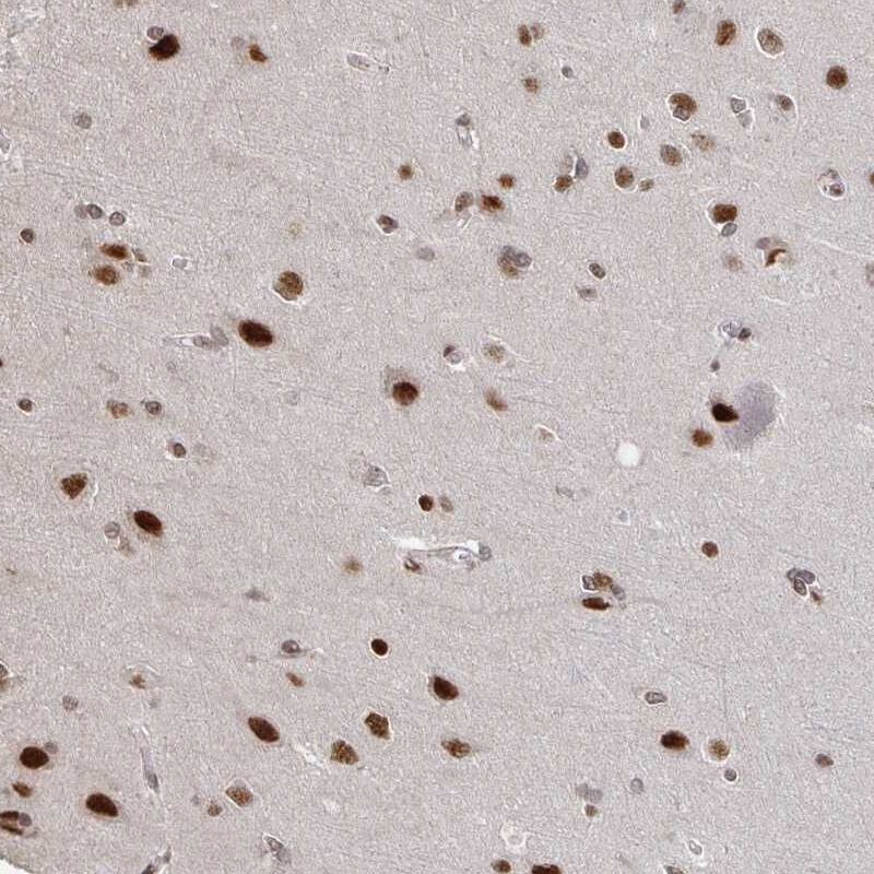 ZDHHC12 Antibody Immunohistochemistry-Paraffin: ZDHHC12 Antibody [NBP2-31763] -