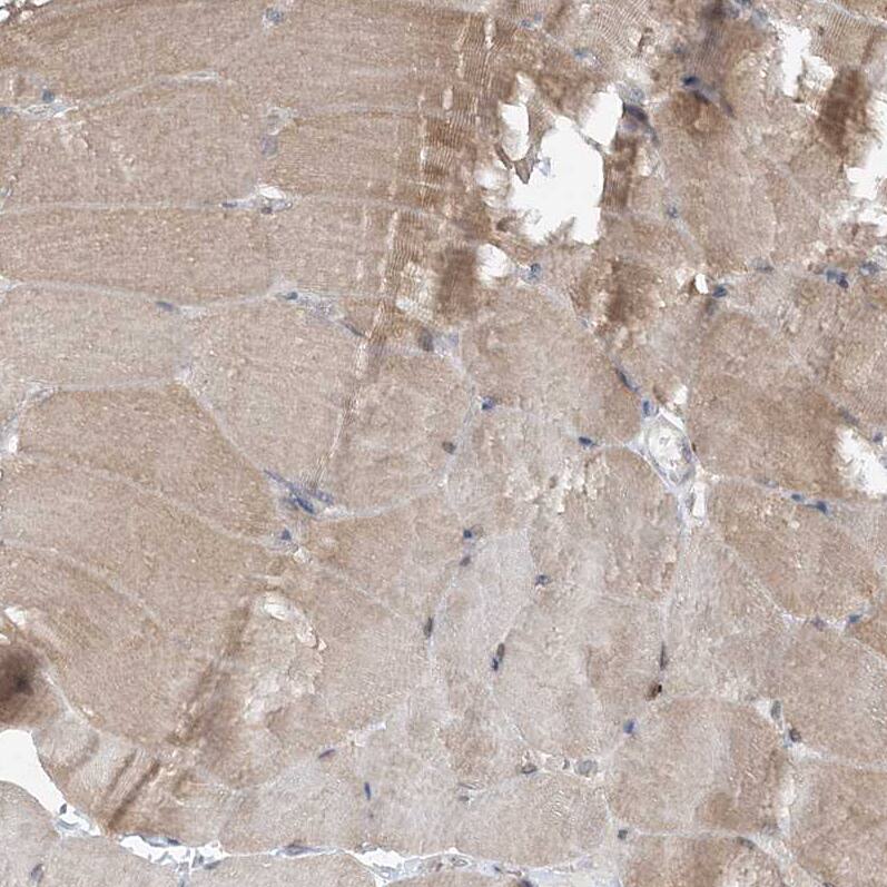 AAMDC Antibody - BSA Free Immunohistochemistry-Paraffin: AAMDC Antibody [NBP2-31969]
