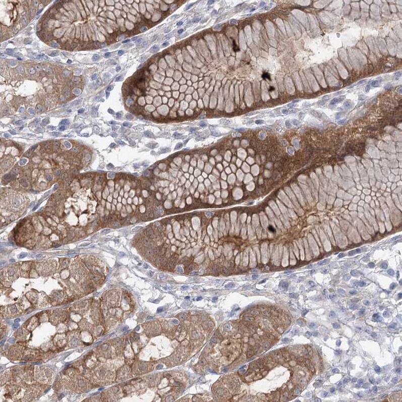 AAMDC Antibody - BSA Free Immunohistochemistry-Paraffin: AAMDC Antibody [NBP2-31969]