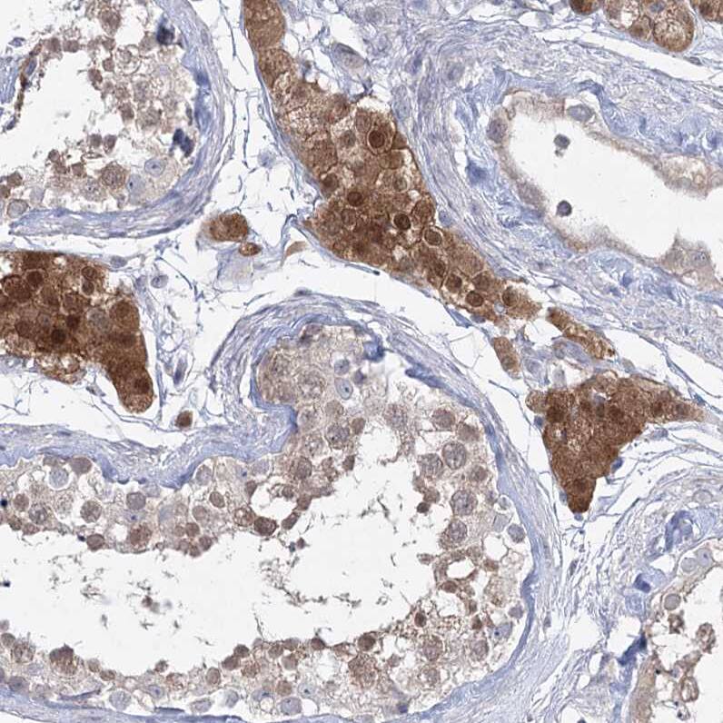 AAMDC Antibody - BSA Free Immunohistochemistry-Paraffin: AAMDC Antibody [NBP2-31969]