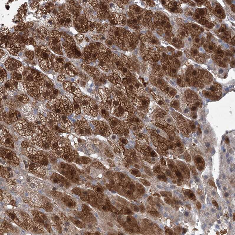 AAMDC Antibody - BSA Free Immunohistochemistry-Paraffin: AAMDC Antibody [NBP2-31969]