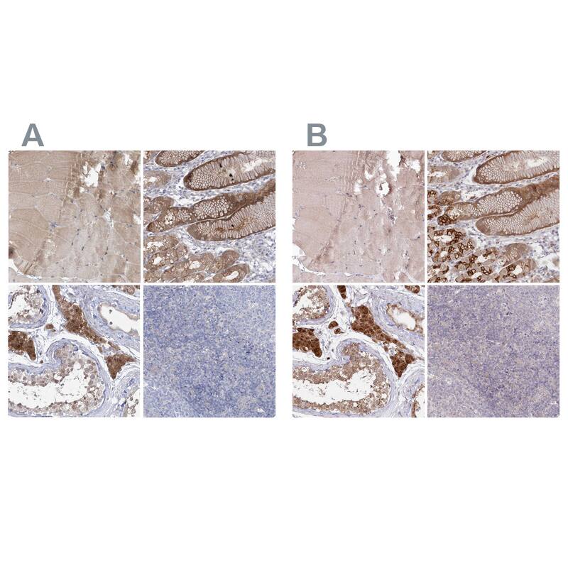 AAMDC Antibody - BSA Free Immunohistochemistry-Paraffin: AAMDC Antibody [NBP2-31969]