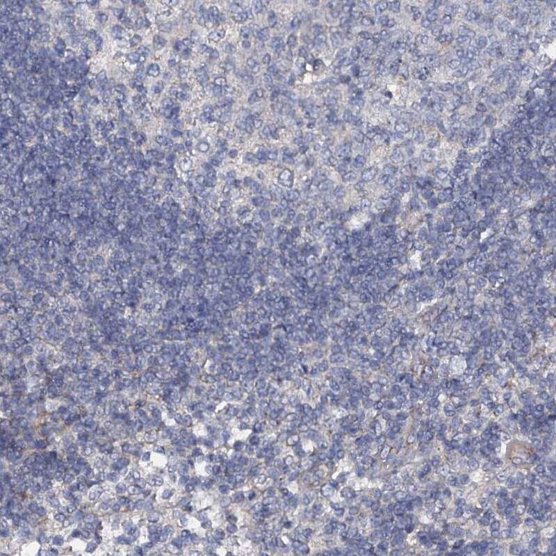 Glucuronic Acid Epimerase Antibody - BSA Free Immunohistochemistry-Paraffin: Glucuronic Acid Epimerase Antibody [NBP2-31985]