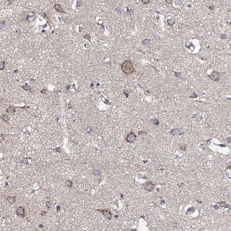 Glucuronic Acid Epimerase Antibody - BSA Free Immunohistochemistry-Paraffin: Glucuronic Acid Epimerase Antibody [NBP2-31985]
